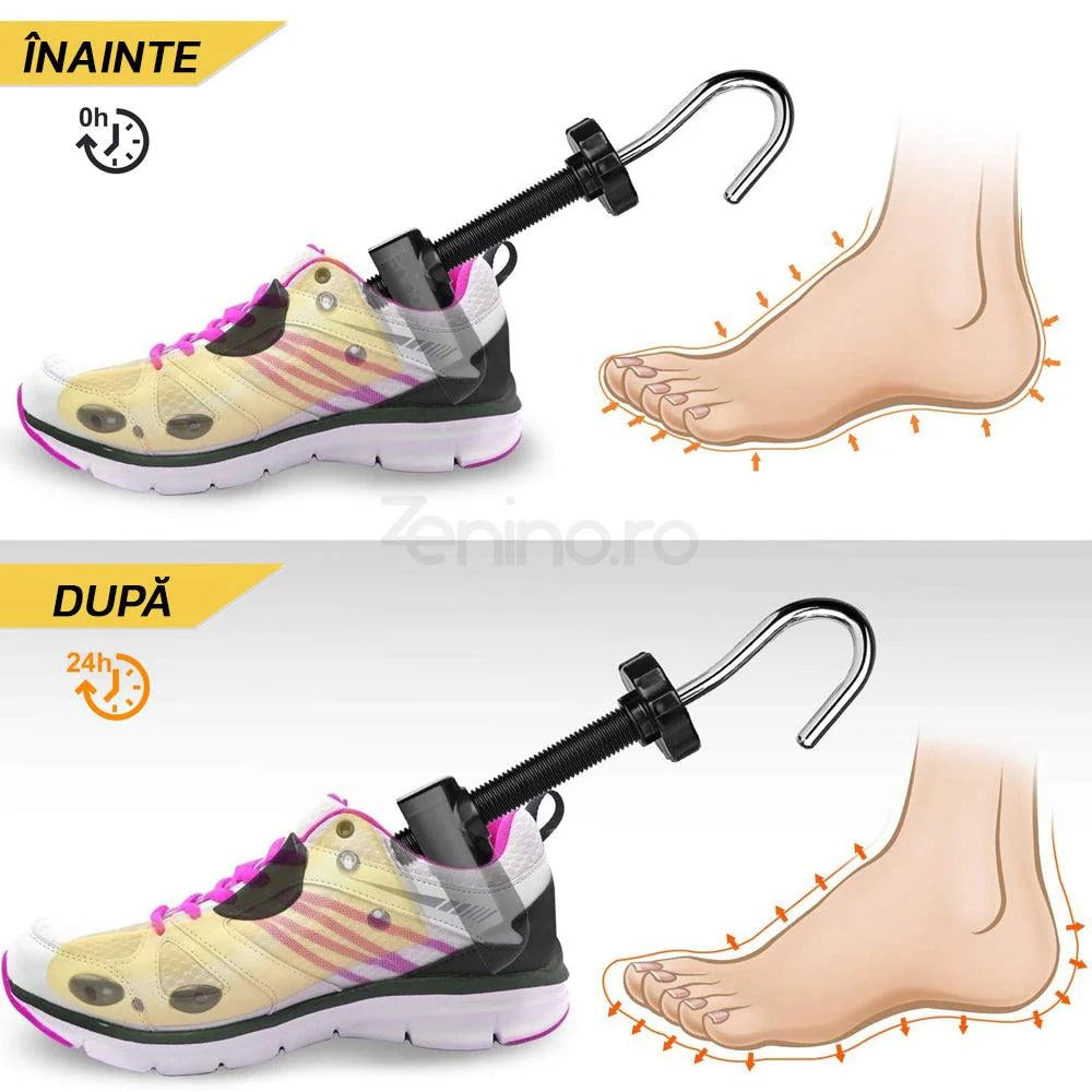 1+1 gratis Calapod reglabil pentru alungit și lărgit pantofi – universal Mix Mart